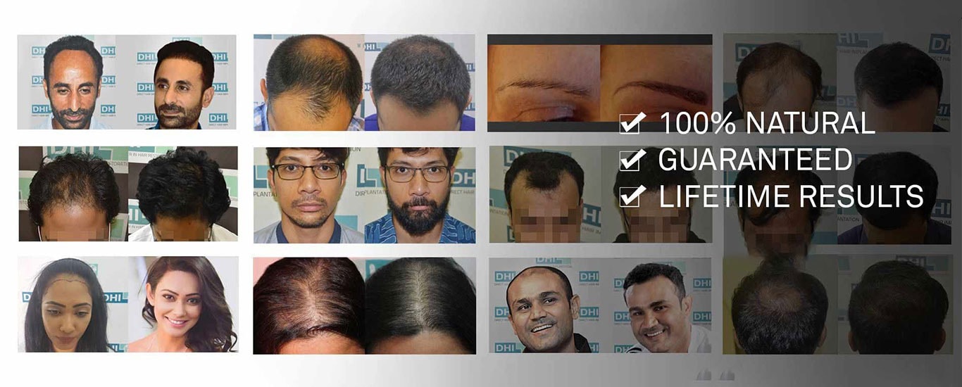 Cosmo Hair Transplant Center - Hair Loss Transplant and Scalp Treatment Doctor in Banjara Hills, Hyderabad